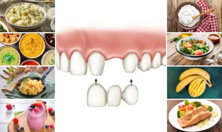 چند وقت بعد از ترمیم دندان نباید چیزی خورد؟