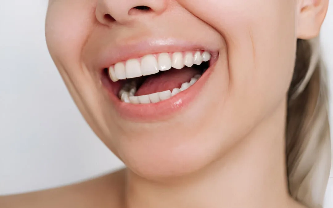 بلیچینگ دندان برای چه افرادی مناسب نیست؟ هشدارها و نکات مهم