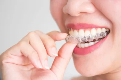 ایا با لمینت متحرک دندان میشه غذا خورد؟