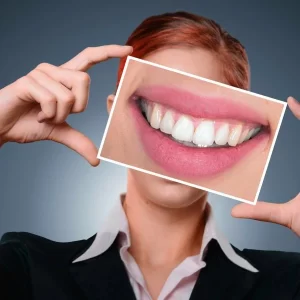لمینت دندان برای چه کسانی مناسب است