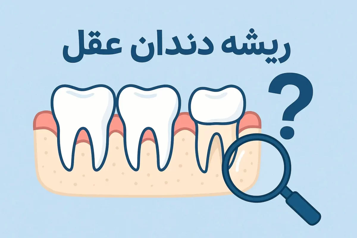 عکس ریشه دندان عقل