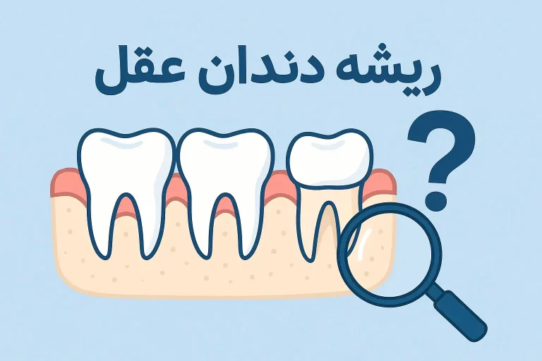 عکس ریشه دندان عقل
