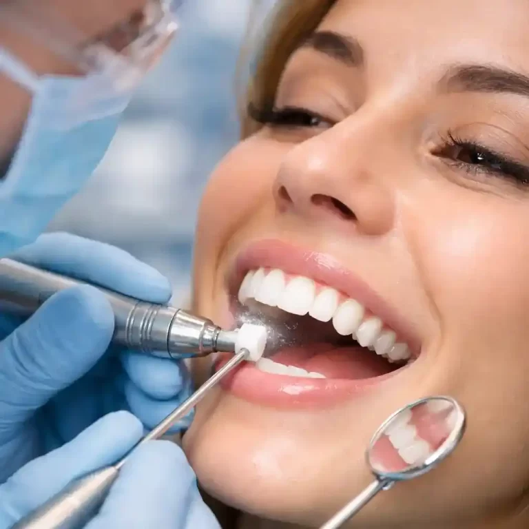 سفید کردن کامپوزیت دندان