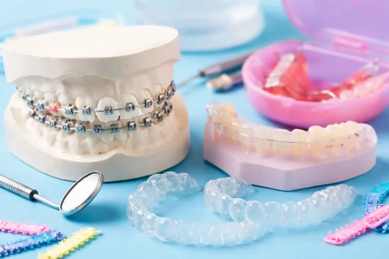 چرا بعد از ارتودنسی دندان کج میشود؟